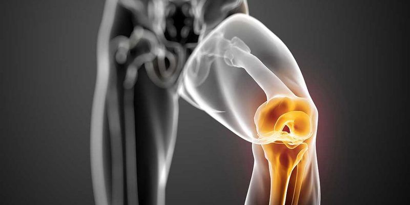liječenje mrvica i bolova u zglobovima koljena magnetski uređaj za liječenje artroze
