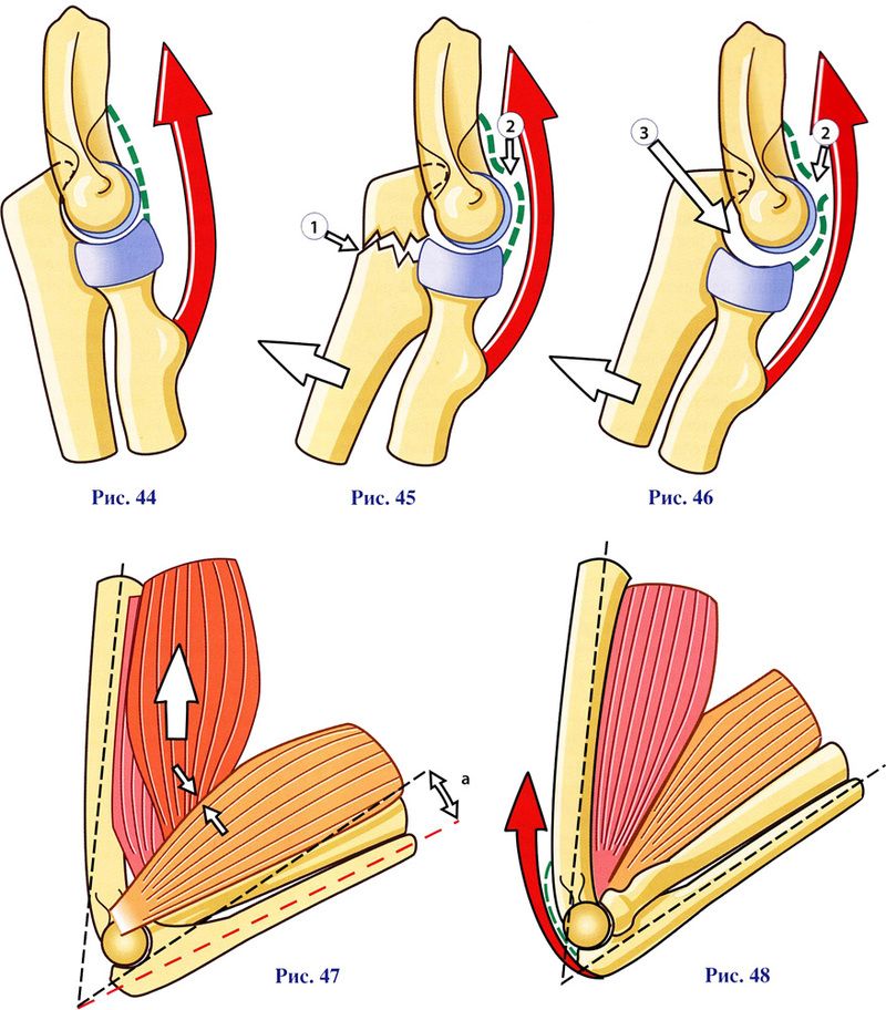 metode liječenja boli u zglobovima i mišićima bol u zglobovima bez oticanje