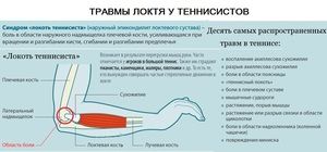 bolovi u mišićima u lakatnom zglobu tijekom ekstenzije)