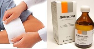 komprimirajte dimeksidom za bolove u zglobovima)