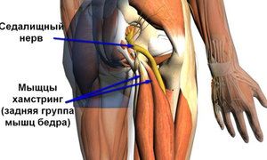 bol u donjem dijelu trbuha koji se proteže do zgloba kuka