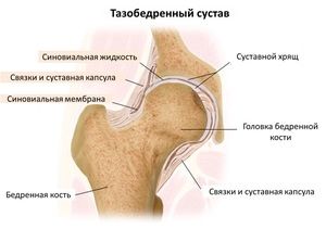 liječenje jake boli u zglobu kuka)