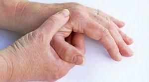 Liječenje ruku artritisa - Kifoze - 
