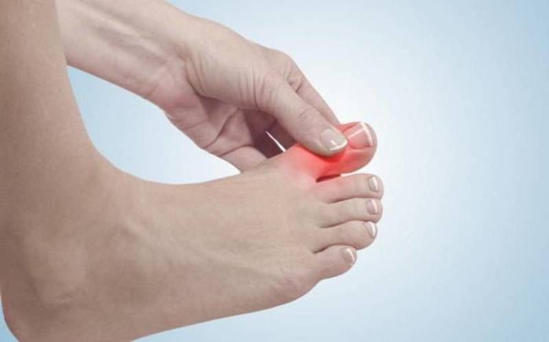 Značajke dijagnoze i liječenja artroze zglobova stopala - Artroza April
