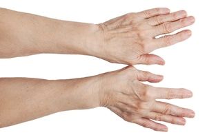 artritične prste oružja liječenje