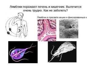 paraziti u jetri simptomi)