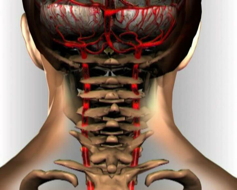 Bolovi u vratu: Zašto točno nastaju i koje 4 vježbe mogu pomoći kod problema?