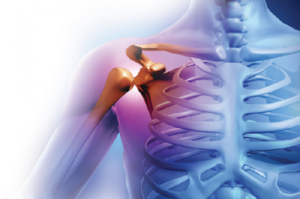 liječenje osteoartritisa ramena