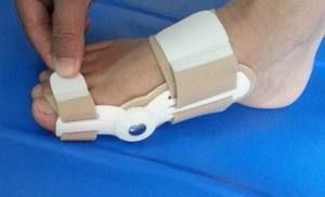 kako ukloniti bol u zglobovima nožnih prstiju)