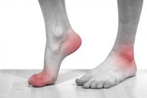 učinkovito liječenje artroze stopala artroza liječenja zgloba koljena u rusiji
