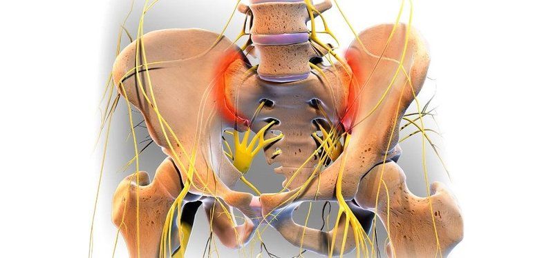 liječenje osteoartritisa sakroilijakalnog zgloba elektroforeza za liječenje artroze koljena