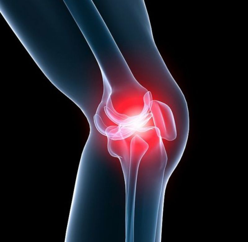 deformirajuća artroza akutne boli u koljenu