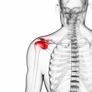Kako problemi s tetivom bicepsa mogu uzrokovati bol u ramenima - Zdravlje - 