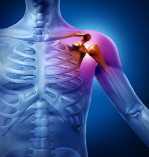 Sindrom bolnog ramena: simptomi i liječenje bolesti ramena