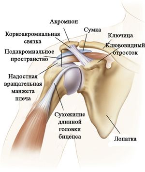 Bol u zglobu ramena: liječenje - Kila 