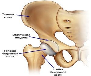 bol u zglobu kuka s intervertebralnom hernijom bol na lijevoj strani koljena