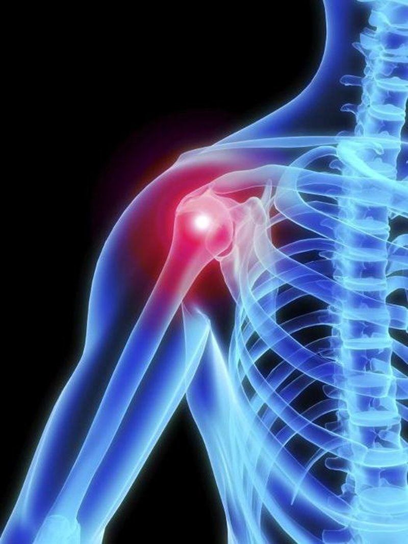 artroza ramenog zgloba liječenje 1 stupanj