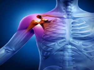 liječenje artroze ramena u ramenu)