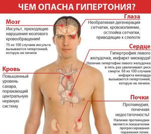 prvi znakovi visokog krvnog tlaka kod muškaraca)