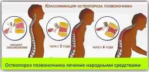 artroza i liječenje osteoporoze)
