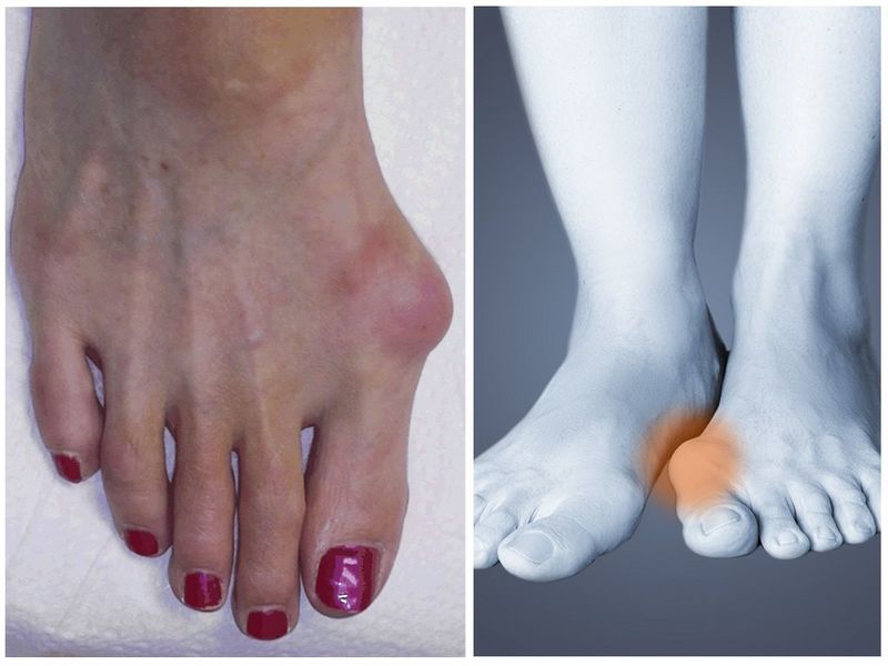 Bolna stanja i ozljede skočnog zgloba i stopala | Poliklinika Scipion