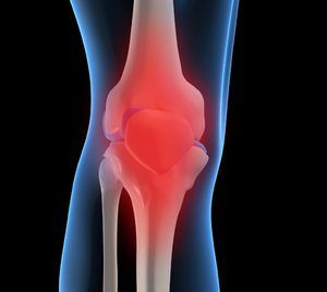 homeopatija zgloba koljena