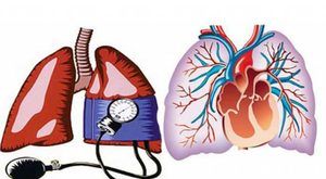 Umjerena plućna hipertenzija: uzroci, simptomi, liječenje, prognoza - Komplikacije January