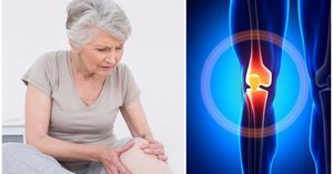 artroza i artritis liječenja zgloba gležnja