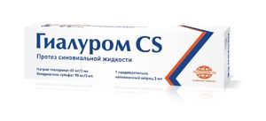 hijaluronske injekcije u liječenju artroze)