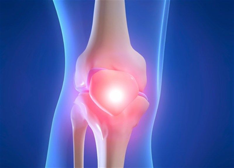 Osteoartritis i bolovi u zglobovima: simptomi i liječenje - Dietpharm