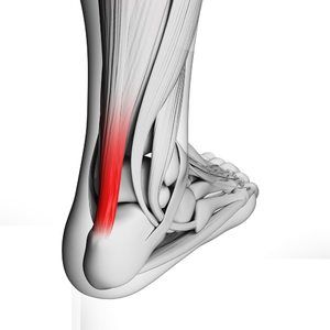 bol u lijevoj strani zglobova liječenje artroze koljena soda