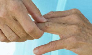 bol u zglobovima nožnih prstiju s artritisom